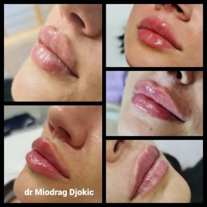 Stomatološka ordinacija Beograd DENTAL & AESTHETIC CENTER BY DR MIODRAG ĐOKIĆ