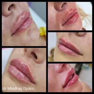 Stomatološka ordinacija Beograd DENTAL & AESTHETIC CENTER BY DR MIODRAG ĐOKIĆ