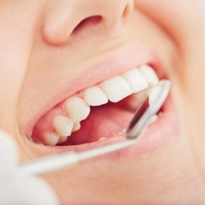 Specijalistička stomatološka ordinacija Beograd JOVANOVIĆ DENTAL