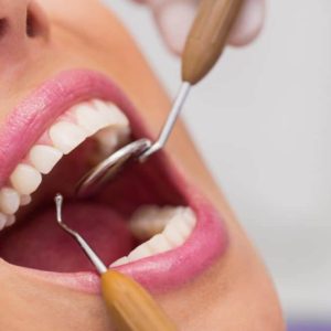 Specijalistička stomatološka ordinacija Beograd JOVANOVIĆ DENTAL