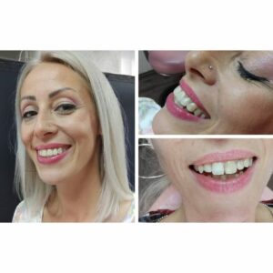 Stomatološka ordinacija Trstenik SMILE DENT