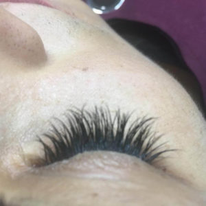 OZON ESTHETIC MEDIC – Jagodina