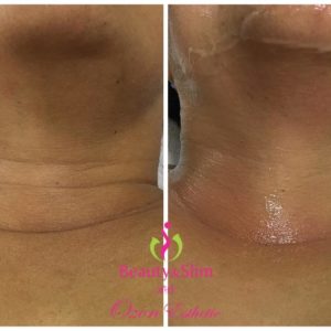 OZON ESTHETIC MEDIC – Jagodina