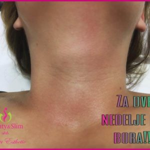 OZON ESTHETIC MEDIC – Jagodina