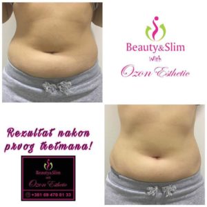OZON ESTHETIC MEDIC – Jagodina