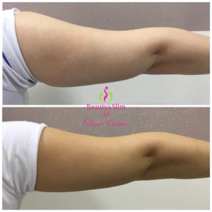 OZON ESTHETIC MEDIC – Jagodina