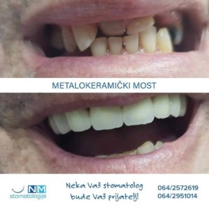Stomatološka ordinacija NM – Niš