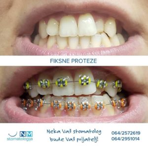 Stomatološka ordinacija NM – Niš