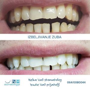 Stomatološka ordinacija NM – Niš