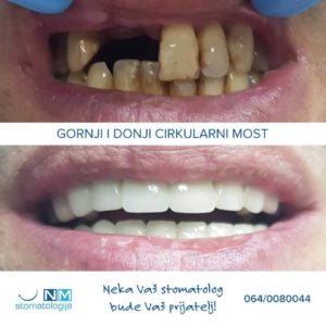 Stomatološka ordinacija NM – Niš