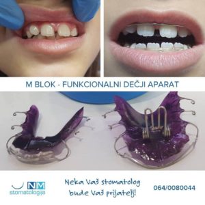 Stomatološka ordinacija NM – Niš