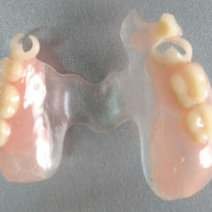 Zubnotehnička laboratorija Čačak MINI DENTAL