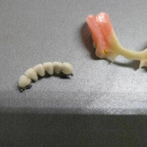 Zubnotehnička laboratorija Čačak MINI DENTAL