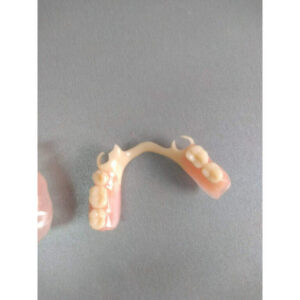 Zubnotehnička laboratorija Čačak MINI DENTAL