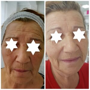 Nega lica i tela Smederevo – BEAUTIFUL FACE