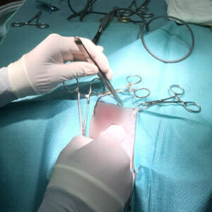 Plastična i estetska hirurgija MARAŠ Kragujevac