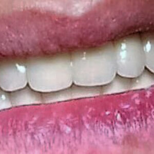 Stomatološka ordinacija GLUMAC DENT Sremska Mitrovica