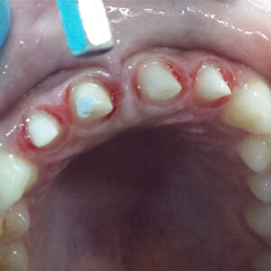 Stomatološka ordinacija GLUMAC DENT Sremska Mitrovica