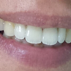 Stomatološka ordinacija GLUMAC DENT Sremska Mitrovica