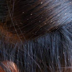 Čišćenje vašaka Mira Novi Sad