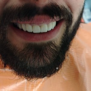 Stomatološka ordinacija Subotički Stara Pazova