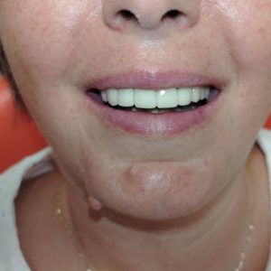 Stomatološka ordinacija Subotički Stara Pazova