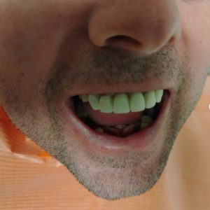 Stomatološka ordinacija Subotički Stara Pazova